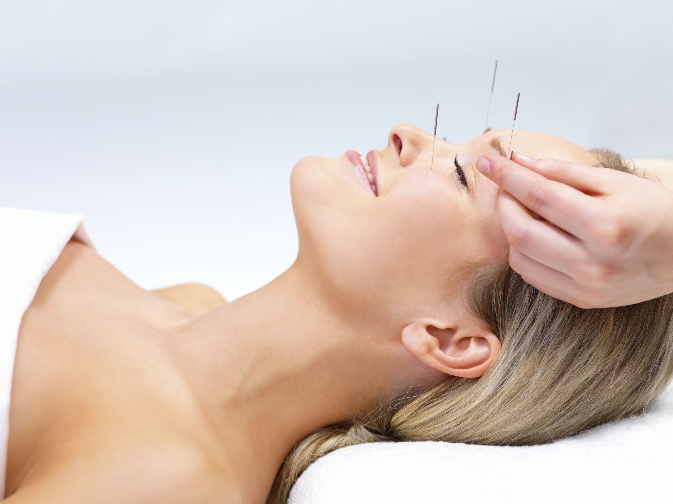 Relaxed woman receiving facial acupuncture therapy for wellness and skin rejuvenation.